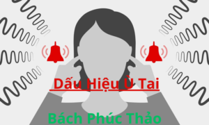 Dấu Hiệu Ù Tai