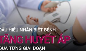 Dấu hiệu tăng huyết áp