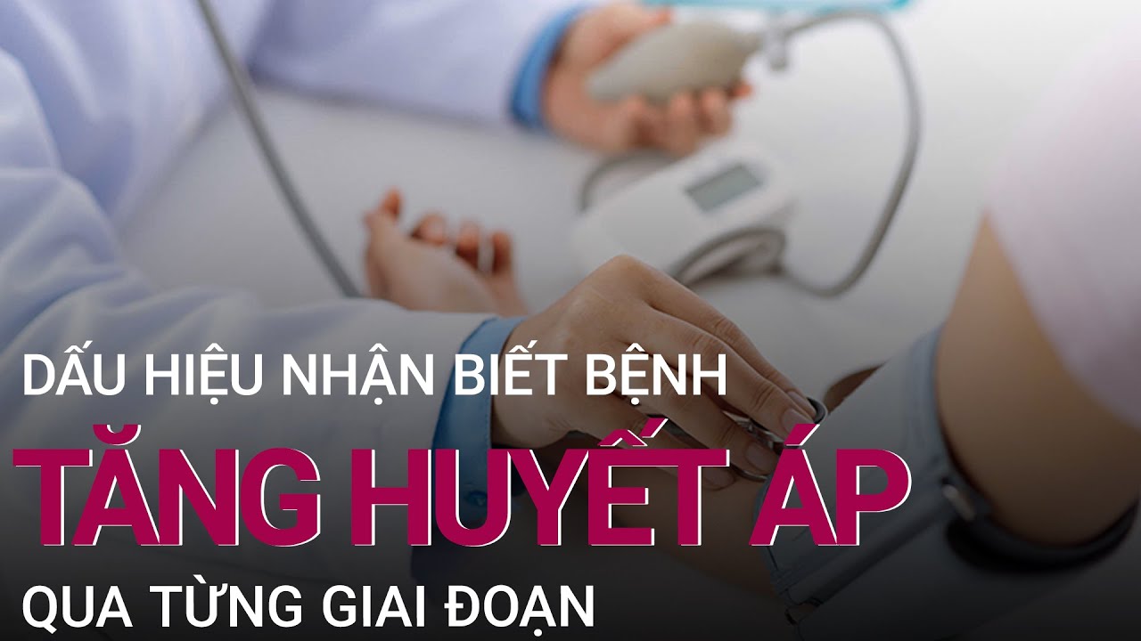 Dấu hiệu tăng huyết áp