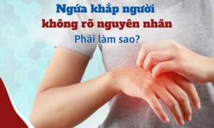 Bị Ngứa Khắp Người Không Rõ Nguyên Nhân