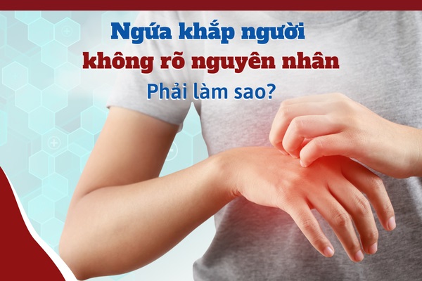 Bị Ngứa Khắp Người Không Rõ Nguyên Nhân