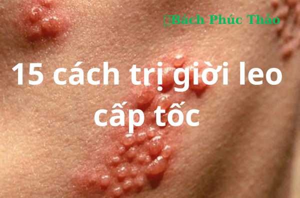 Cách Trị Giời Leo Cấp Tốc