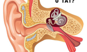 Chữa ù tai nghe tiếng mạch đập